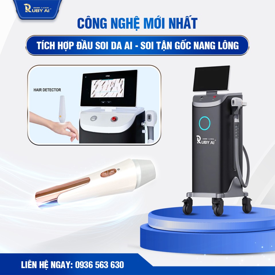 Ưu Điểm Khi Đầu Tư Máy Ruby AI